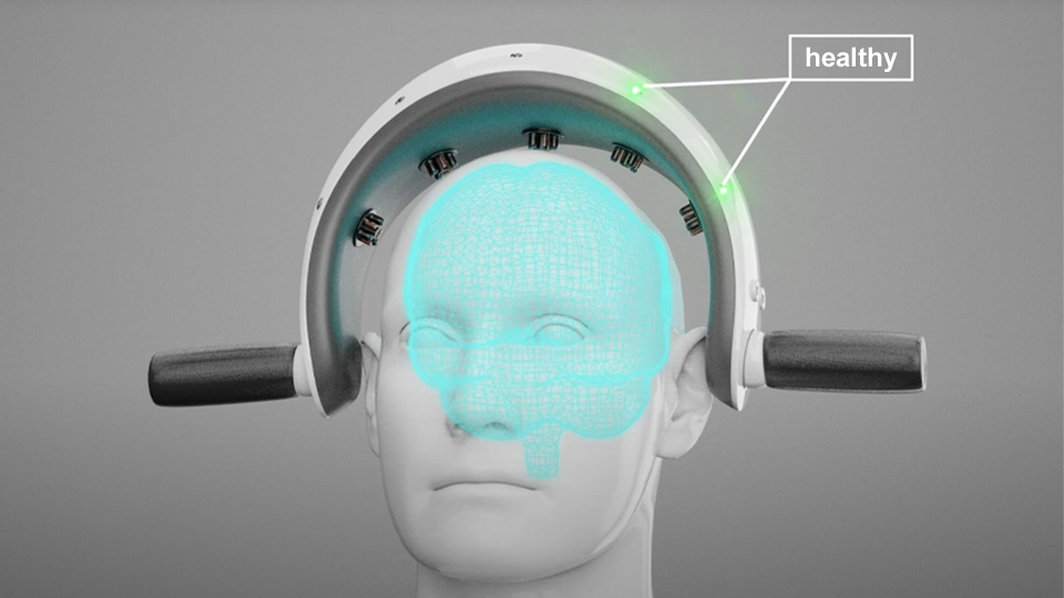 ScansX公司的AI技術手持式掃描儀3D呈現