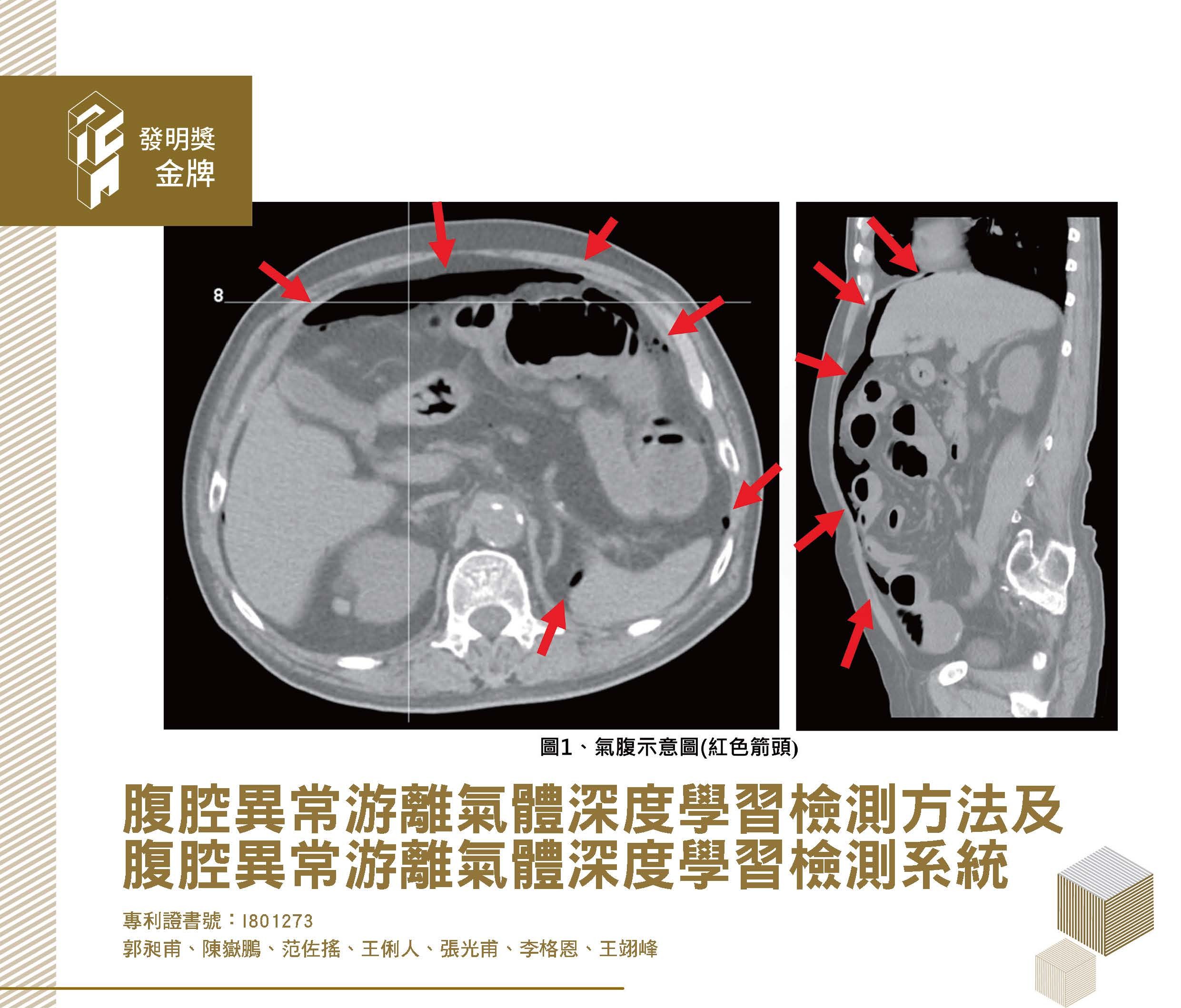 113國家發明創作獎得獎專輯(中文)_v13-1_頁面_18